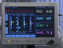 Advanced Hemodynamic Monitor