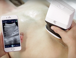 Portable Cardiology