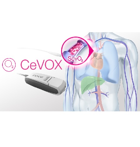 Philips Cevox Philips Cevox