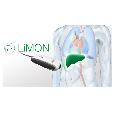 Philips Limon Philips Limon